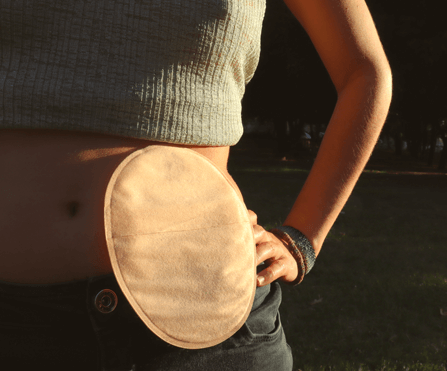 Soins De Stomie Lodelinsart SOINS INFIRMIERS ALEM BARROU